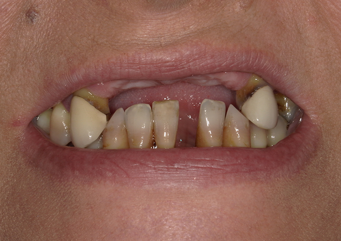 Before - Fusion Dental