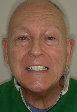 face - Fusion Dental