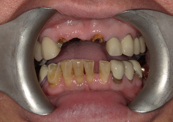 Before - Fusion Dental