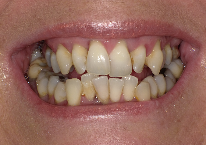Before - Fusion Dental