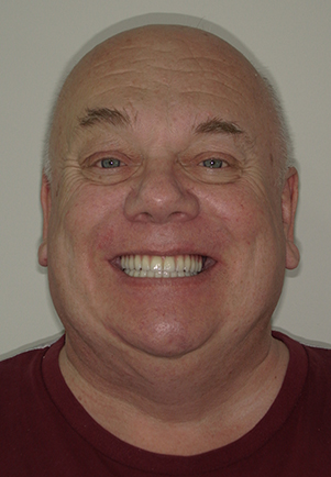 face - Fusion Dental