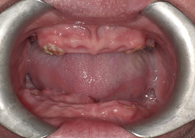 Before - Fusion Dental