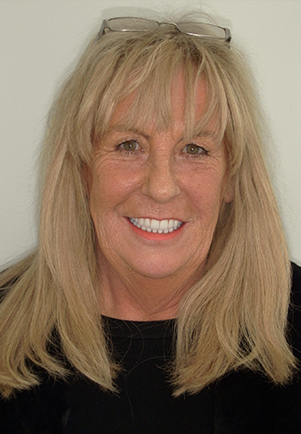 face - Fusion Dental