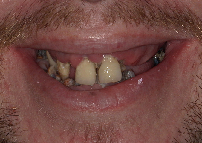 Before - Fusion Dental