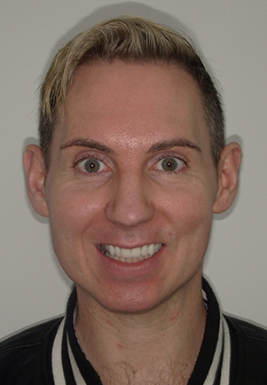 face - Fusion Dental