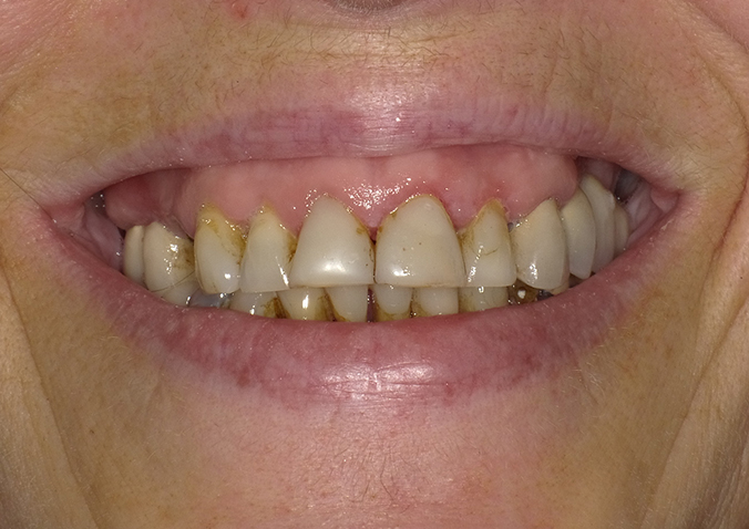 Before - Fusion Dental