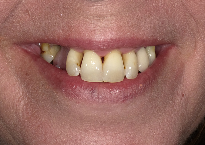 Before - Fusion Dental