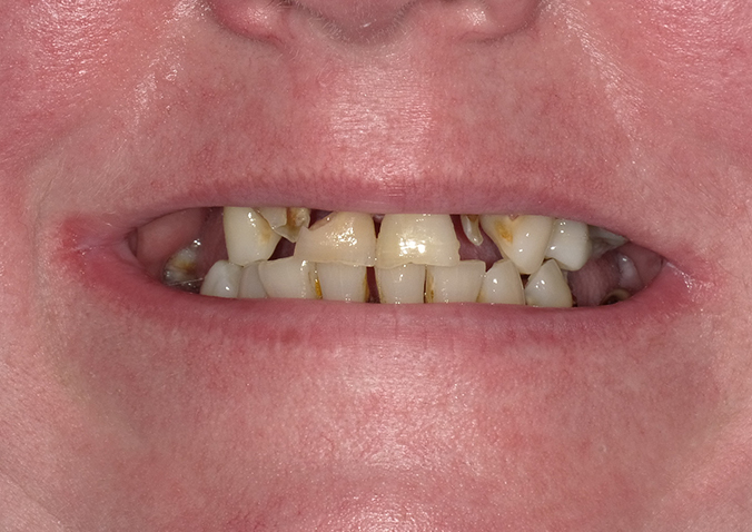 Before - Fusion Dental
