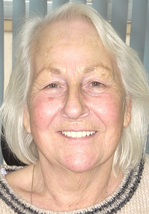 face - Fusion Dental