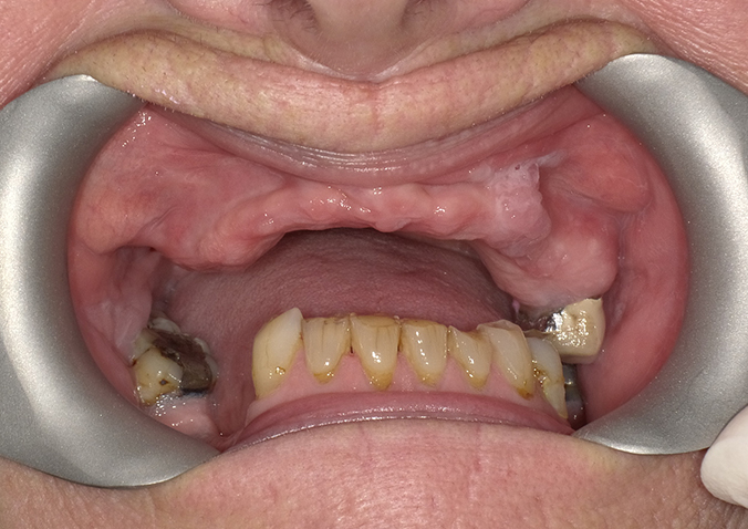 Before - Fusion Dental