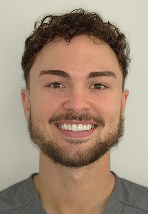 face - Fusion Dental