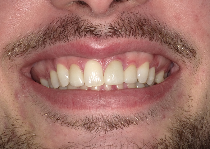 Before - Fusion Dental