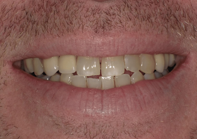 Before - Fusion Dental