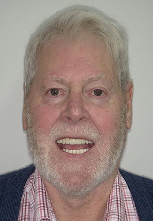 face - Fusion Dental