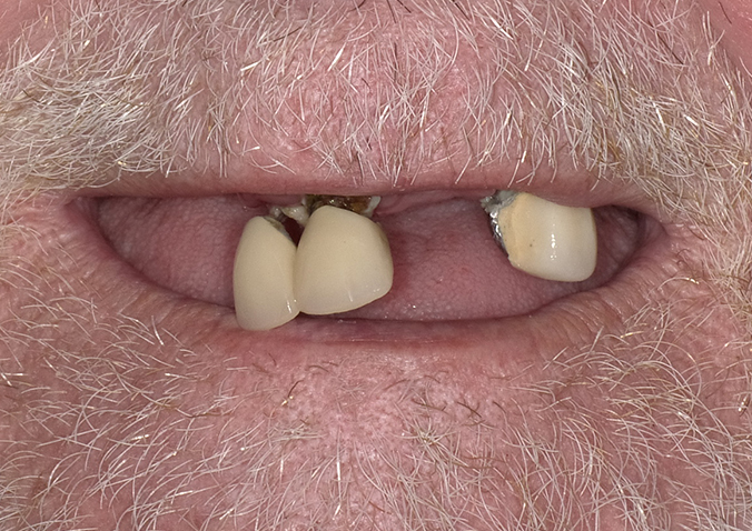 Before - Fusion Dental