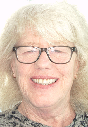 face - Fusion Dental