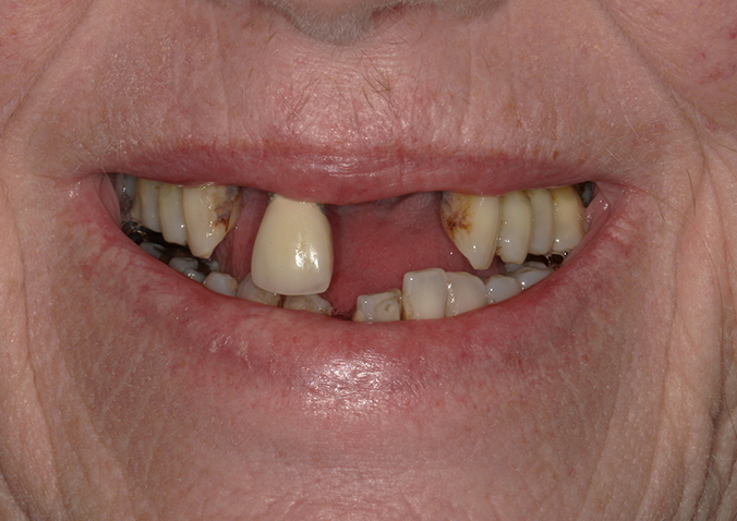 Before - Fusion Dental