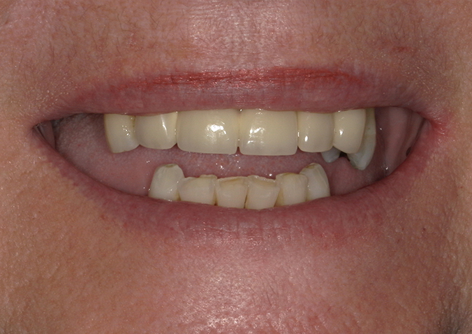 Before - Fusion Dental